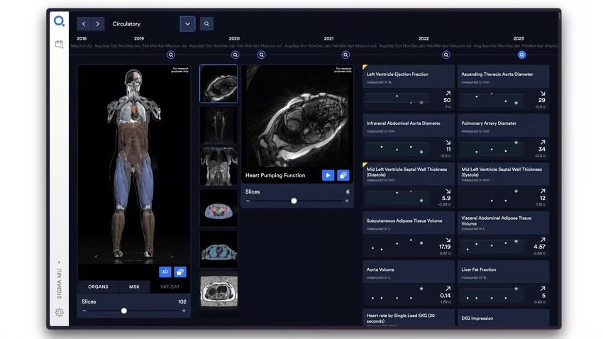 Q Bio furthers measurement in medical imaging with Tensor Field Mapping ...