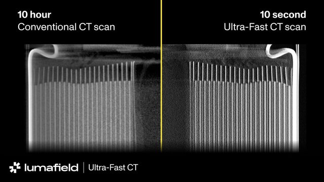 10 second Ultra-Fast CT scan versus 10 hour traditional scan